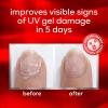 imageessie nail care UV gel damage repair nail treatment to the rescue nail repair base coat 046 fl oz